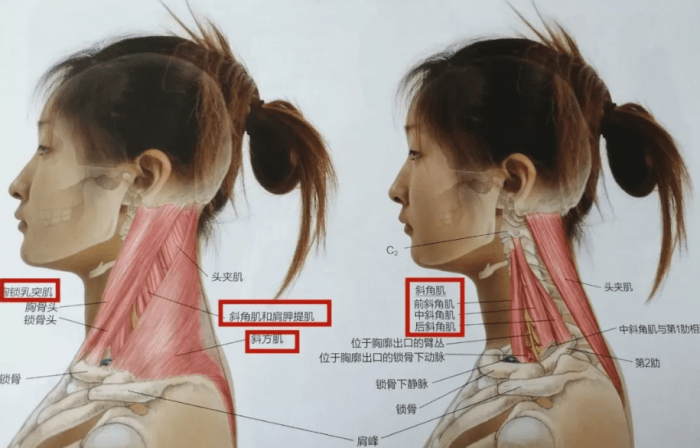 落枕的自我診斷